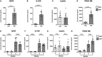 Platelet-Rich Plasma Supports Proliferation and Redifferentiation of Chondrocytes during In Vitro Expansion